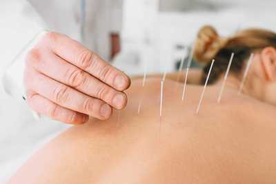 Link to: /pages/acupuncture